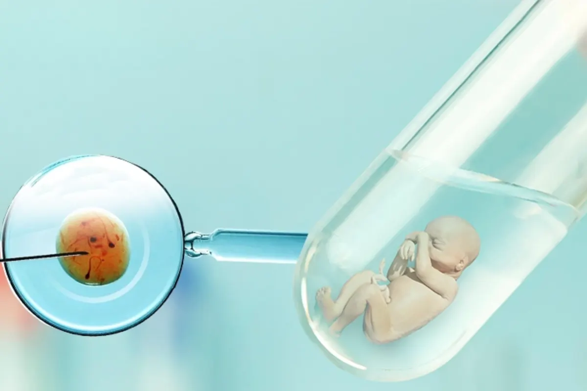 IVF ICSI test tube baby treatment at AnuSri Hospitals Secunderabad Hyderabad